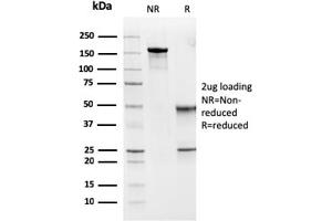 SDS-PAGE Analysis Purified MSH6 Mouse Monoclonal Antibody (MSH6/3091). (MSH6 anticorps  (AA 374-540))