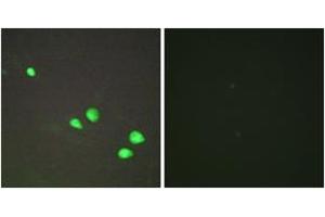 Immunofluorescence analysis of HepG2 cells, using CHD4 Antibody.