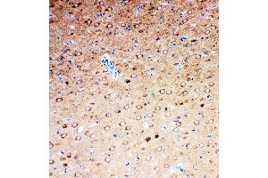 Anti-Serotonin transporter antibody, IHC(P) IHC(P): Rat Brain Tissue (SLC6A4 anticorps  (N-Term))