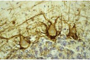 Immunostaining of human cerebellar cortex showing labeling of NF-H (brown) in basket cell axons surrounding the large Purkinje neurons.