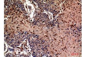 Immunohistochemistry (IHC) analysis of paraffin-embedded Human Lung, antibody was diluted at 1:100. (Ubiquitin anticorps  (Internal Region))