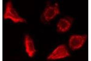 ABIN6278325 staining HepG2 cells by IF/ICC.