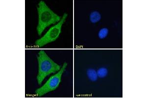 ABIN185380 Immunofluorescence analysis of paraformaldehyde fixed MCF7 cells, permeabilized with 0. (BID anticorps  (C-Term))