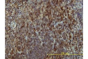 Immunoperoxidase of monoclonal antibody to LAT on formalin-fixed paraffin-embedded human tonsil tissue.