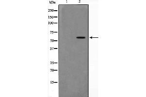 Western blot analysis of extracts of HT-29 cell line,usingPAK4antibody (PAK4 anticorps  (Internal Region))