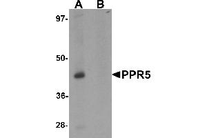 Western blot analysis of PRR5 in SK-N-SH cell lysate with PRR5 antibody at 1 µg/mL in (A) the absence and (B) the presence of blocking peptide (PRR5 anticorps  (C-Term))