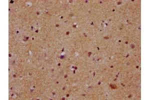 IHC image of ABIN7168374 diluted at 1:300 and staining in paraffin-embedded human brain tissue performed on a Leica BondTM system. (MEX3B anticorps  (AA 253-375))