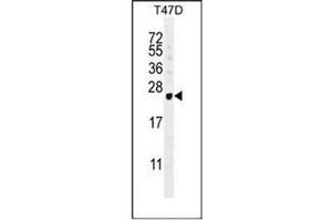 Western blot analysis of GAGE12B Antibody (N-term) in T47D cell line lysates (35ug/lane). (G Antigen 12B anticorps  (N-Term))