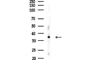 anti-EBNA1 Binding Protein 2 (EBNA1BP2) (Internal Region) antibody