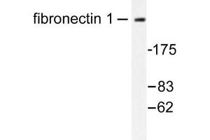 Image no. 1 for anti-Fibronectin antibody (ABIN272101) (Fibronectin anticorps)