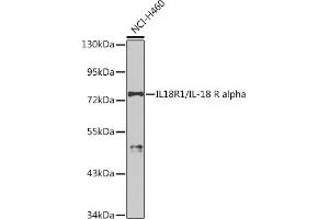 Western blot analysis of extracts of NCI-H460 cells, using IL18R1/IL-18 R alpha antibody (ABIN3023690, ABIN3023691, ABIN3023692 and ABIN6219764) at 1:1000 dilution.