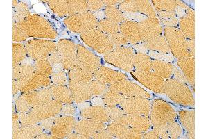 ABIN6258681 and ABIN6274241 at 1/100 staining Rat skin tissue by IHC-P. (ACTN2/3 anticorps  (N-Term))