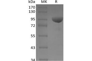 Western Blotting (WB) image for EPH Receptor B1 (EPHB1) protein (Fc Tag) (ABIN7319920)