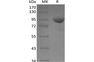 Western Blotting (WB) image for EPH Receptor B1 (EPHB1) protein (Fc Tag) (ABIN7319920) (EPH Receptor B1 Protein (EPHB1) (Fc Tag))