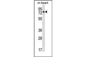 Western blot analysis of PARP2 Antibody (C-term) in mouse heart tissue lysates (35ug/lane). (PARP2 anticorps  (C-Term))