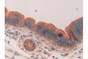 Detection of MUC1 in Mouse Uterus Tissue using Polyclonal Antibody to Mucin 1 (MUC1)