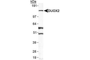 Western blot analysis of DUOX2 in A-549 in cell lysate using DUOX2 polyclonal antibody . (DUOX2 anticorps  (AA 400-500))