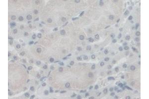 Detection of GFM1 in Mouse Kidney Tissue using Polyclonal Antibody to G-Elongation Factor, Mitochondrial 1 (GFM1)
