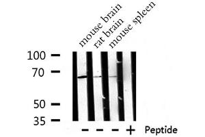Western blot analysis of  RPA1 expression in various lysates (RPA1 anticorps  (Internal Region))