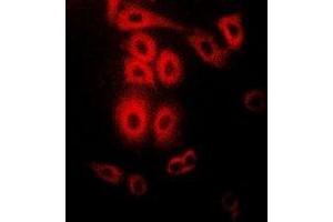 Immunofluorescent analysis of Telethonin staining in Hela cells. (TCAP anticorps)