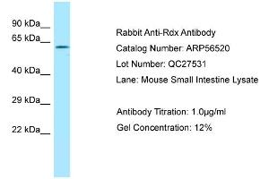 Western Blotting (WB) image for anti-Radixin (RDX) (C-Term) antibody (ABIN2786751) (Radixin anticorps  (C-Term))
