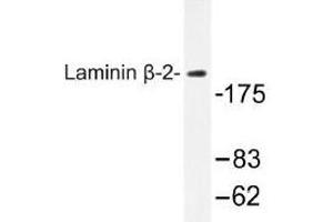 Image no. 1 for anti-Laminin, beta 2 (Laminin S) (LAMB2) antibody (ABIN317724) (LAMB2 anticorps)