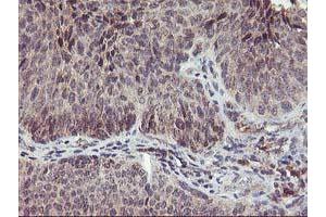 Image no. 2 for anti-Phenylethanolamine N-Methyltransferase (PNMT) antibody (ABIN1500315)