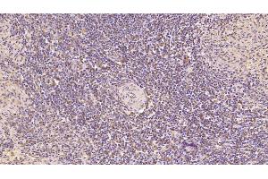 Detection of CDNF in Human Spleen Tissue using Monoclonal Antibody to Cerebral Dopamine Neurotrophic Factor (CDNF)