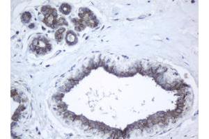 Image no. 5 for anti-Palmitoyl-Protein Thioesterase 1 (PPT1) (AA 100-306) antibody (ABIN1490802)