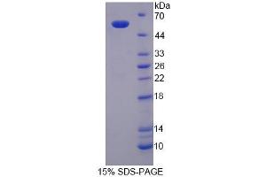 SDS-PAGE analysis of Mouse SPTLC3 Protein. (SPTLC3 Protéine)