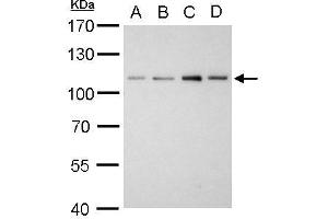 WB Image Alpha Actinin 2 antibody [N1N3] detects ACTN2 protein by western blot analysis. (ACTN2 anticorps)