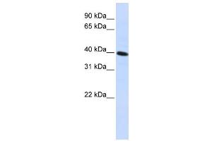 anti-FLJ10769 antibody