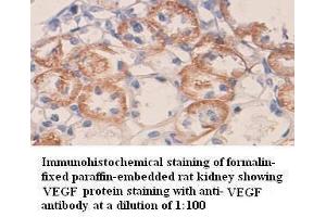 Immunohistochemistry (IHC) image for anti-Vascular Endothelial Growth Factor A (VEGFA) antibody (ABIN6583751) (VEGFA anticorps)