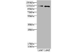 Western blot All lanes: HEPH antibody at 2. (Hephaestin anticorps  (AA 300-580))