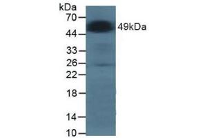 Figure. (GLA anticorps  (AA 81-429))
