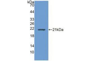 Figure. (UBE2L3 anticorps  (AA 4-154))
