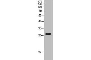 Western Blot analysis of mouse-kidney cells using Antibody diluted at 500. (MBL2 anticorps  (AA 21-70))