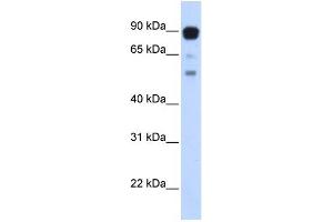 WB Suggested Anti-ZNF408 Antibody Titration:  0.