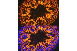 Immunofluorescence analysis of rat testis cells using Calmegin Rabbit mAb (ABIN7266025) at dilution of 1:100 (40x lens).