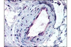 Image no. 1 for anti-Activin Receptor Type I (ACRV1) (AA 475-509) antibody (ABIN372397)