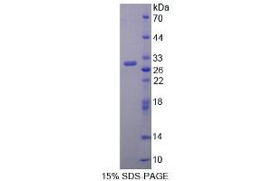 SDS-PAGE analysis of Rat BCAT1 Protein. (BCAT1 Protéine)