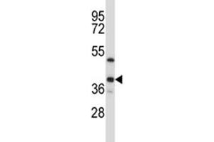 ERCC1 antibody western blot analysis in T47D lysate (ERCC1 anticorps  (AA 268-297))