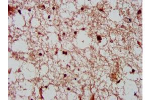 IHC image of ABIN7148847 diluted at 1:600 and staining in paraffin-embedded human brain tissue performed on a Leica BondTM system. (Cyclin-Dependent Kinase 11A (CDK11A) (AA 5-216) anticorps)
