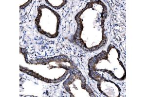 IHC analysis of NKCC1/SLC12A2 using anti-NKCC1/SLC12A2 antibody (ABIN7602602).