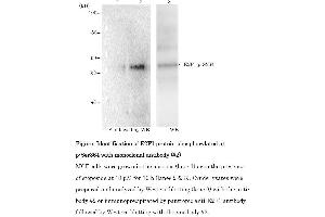 Western Blotting (WB) image for anti-E2F Transcription Factor 1 (E2F1) (pSer364) antibody (ABIN3201010) (E2F1 anticorps  (pSer364))