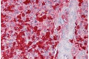 Spleen stained in Immunohistochemistry on Paraffin Sections with S100A9 antibody (S100A9 anticorps  (C-Term))