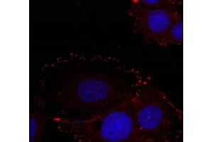 Immunofluorescence staining of methanol-fixed Hela cells using FAK(phospho-Tyr576/Tyr577) Antibody. (FAK anticorps  (pTyr576, pTyr577))