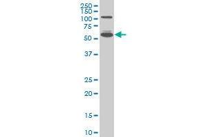 IRF5 monoclonal antibody (M05A), clone 2D4 Western Blot analysis of IRF5 expression in A-431 ( Cat # L015V1 ). (IRF5 anticorps  (AA 395-504))