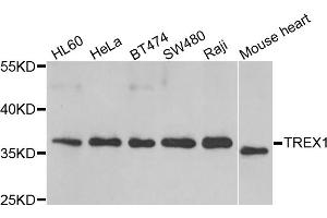 Western blot analysis of extracts of various cell lines, using TREX1 antibody (ABIN5974106) at 1/1000 dilution. (TREX1 anticorps)