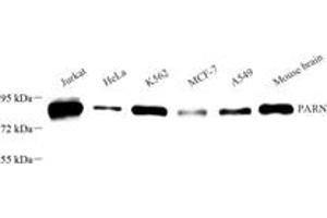 Western blot analysis of PARN (ABIN7075117),at dilution of 1: 1000 (PARN anticorps)